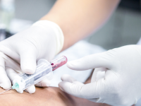 Une prise de sang pour mieux détecter le cancer du poumon