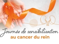 Journée mondiale de sensibilisation au cancer du rein -  Le CHU Dijon Bourgogne mobilisé pour une prise en charge experte, coordonnée et humaine 